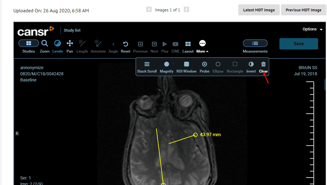 Cansr — Technical Partnership for an Oncology MDT Platform preview 1